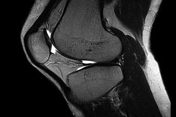 Radiologija u Bolnici Sveti Nikola